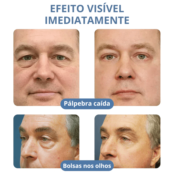 Crème Veze – Lift Paupières et Anti-rides