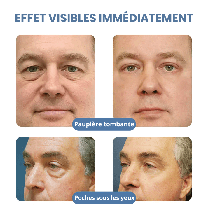 Crème Veze – Lift Paupières et Anti-rides